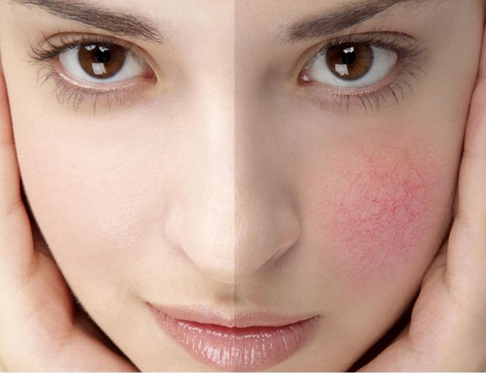 敏感肌換季如何護(hù)理？