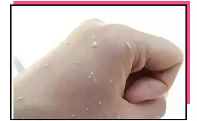 使用護(hù)膚品搓泥的原因有哪些？護(hù)膚品搓泥怎么辦？